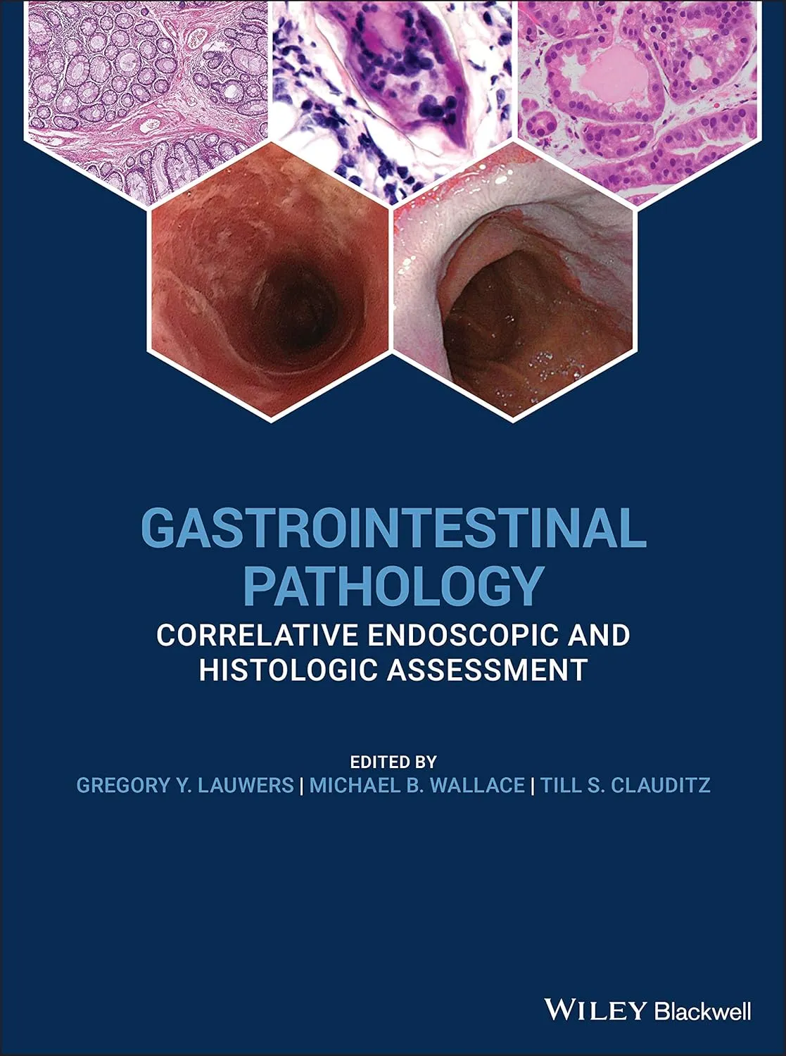 Gastrointestinal Pathology Correlative Endoscopic And Histologic Assessment | Hardcover
