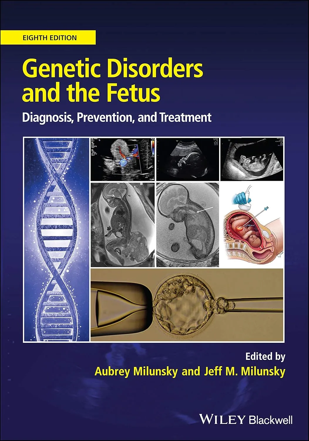 Genetic Disorders And The Fetus Diagnosis Prevention And Treatment 8th Edition | Hardcover