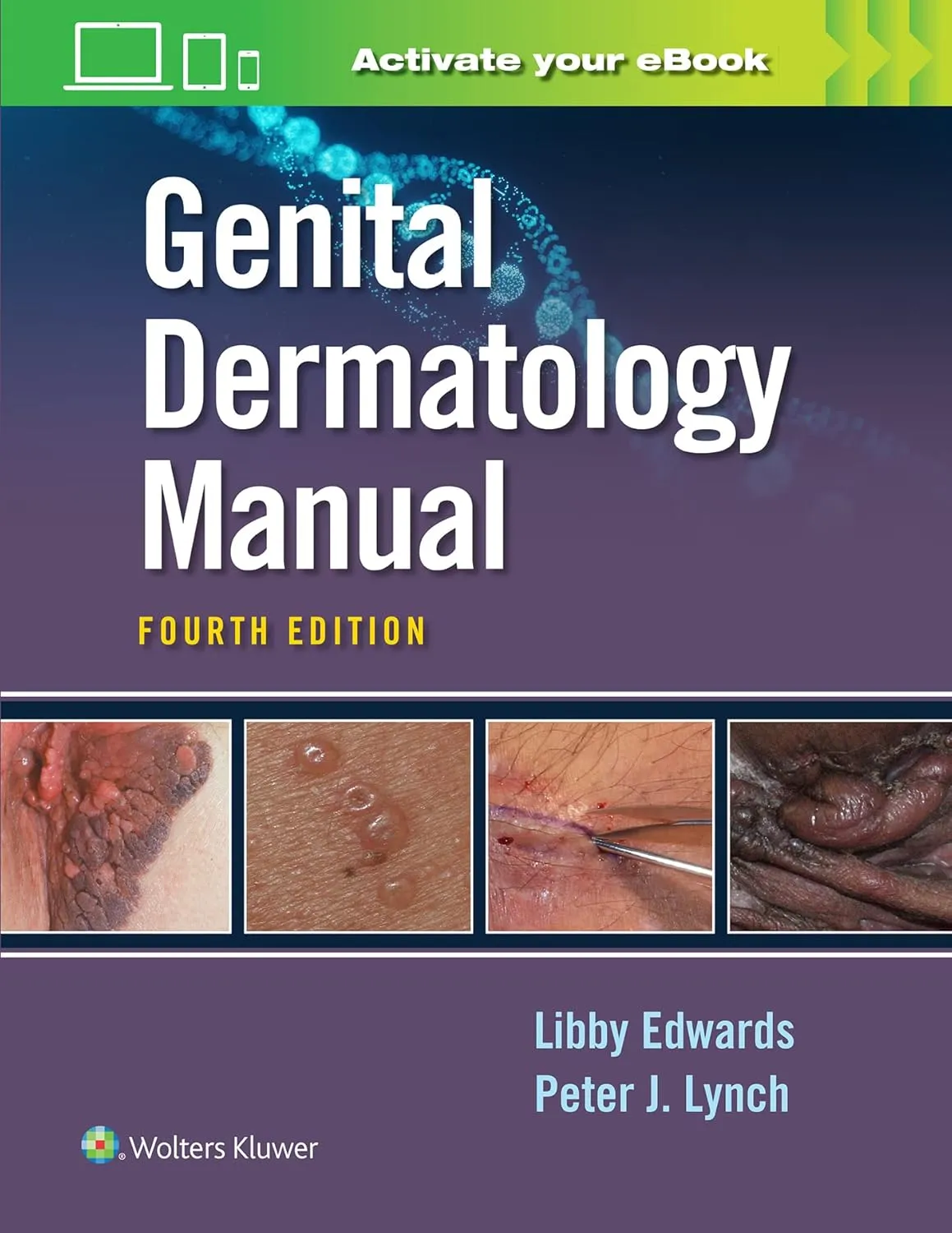 Genital Dermatology Manual With Access Code 4th Edition | Paperback