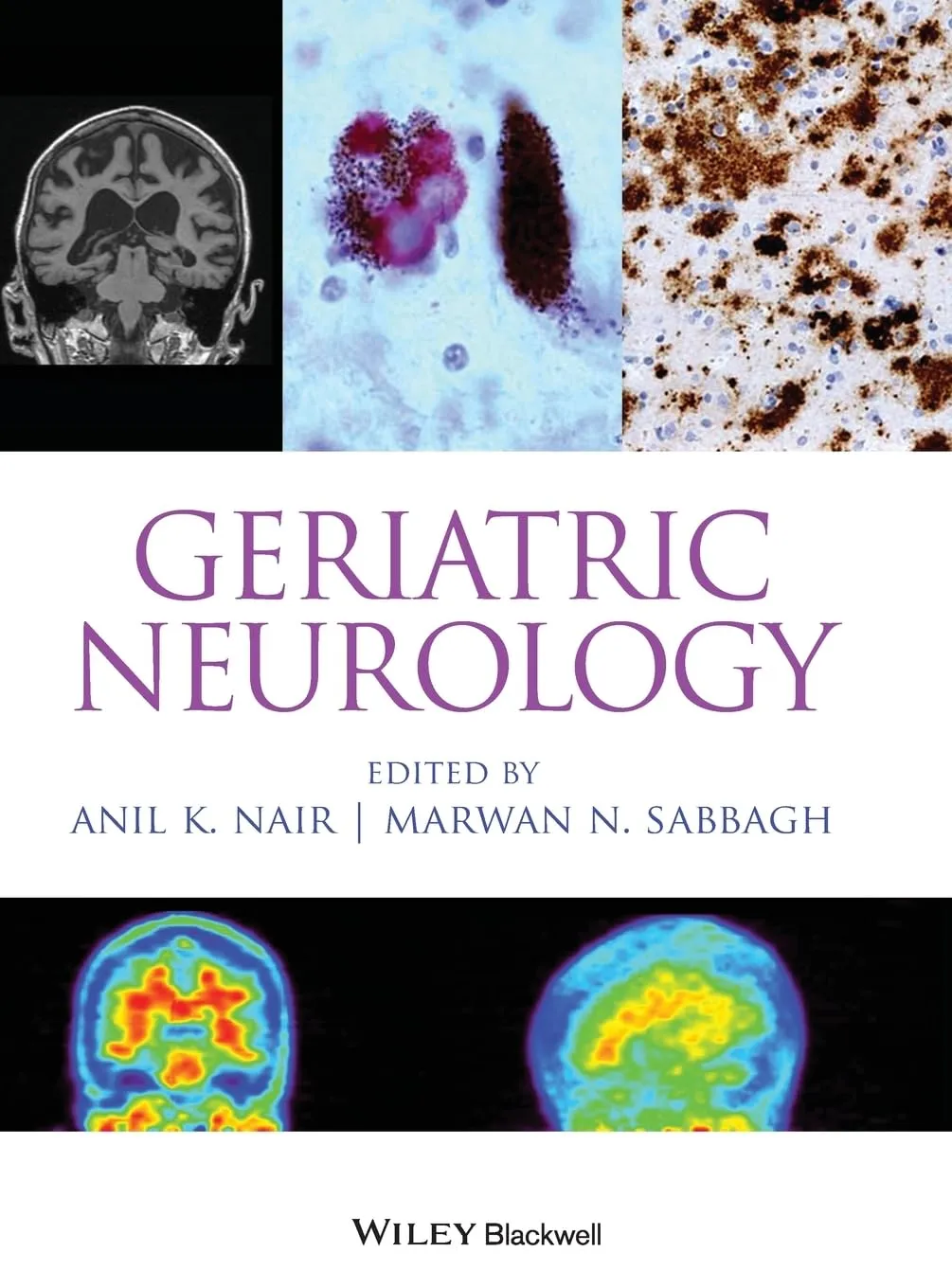 Geriatric Neurology | Hardcover