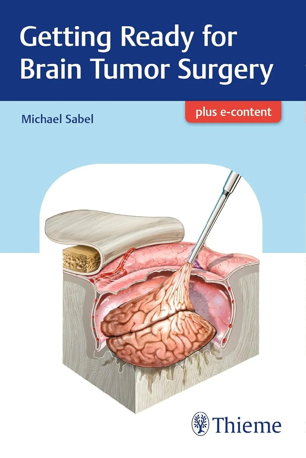 Getting Ready for Brain Tumor Surgery | Paperback
