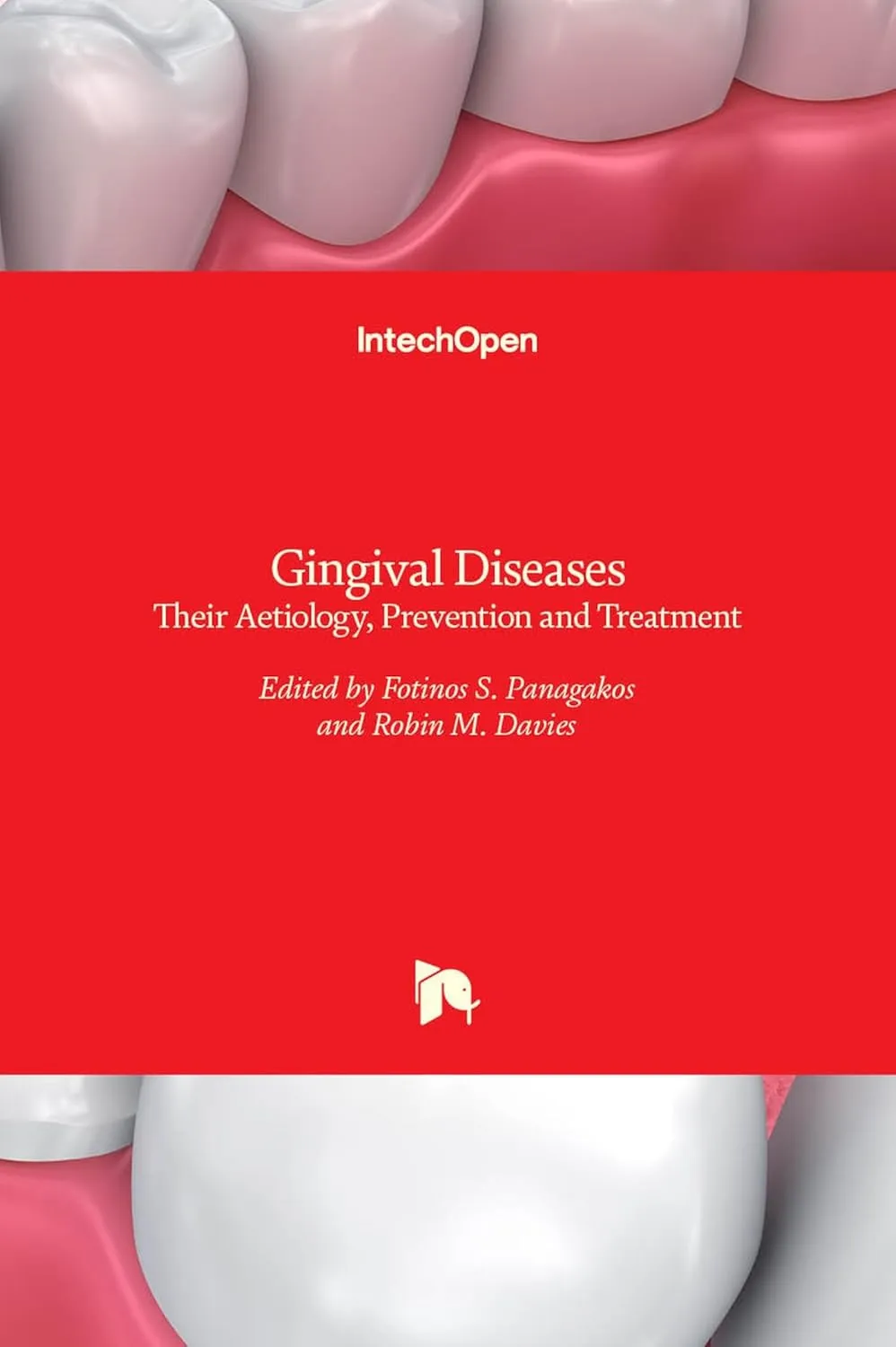 Gingival Diseases Their Aetiology Prevention and Treatment | Hardcover