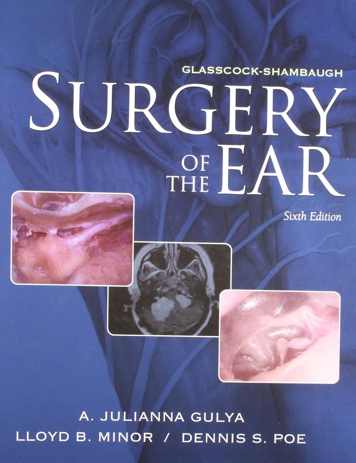 Glasscock-Shambaugh Surgery of the Ear | 6th Edition | Hardcover
