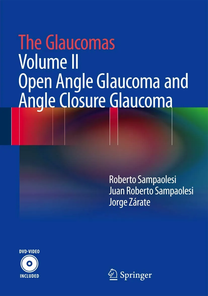 The Glaucomas Open Angle Glaucoma and Angle Closure Glaucoma | Volume 2 | With DVD | Hardcover