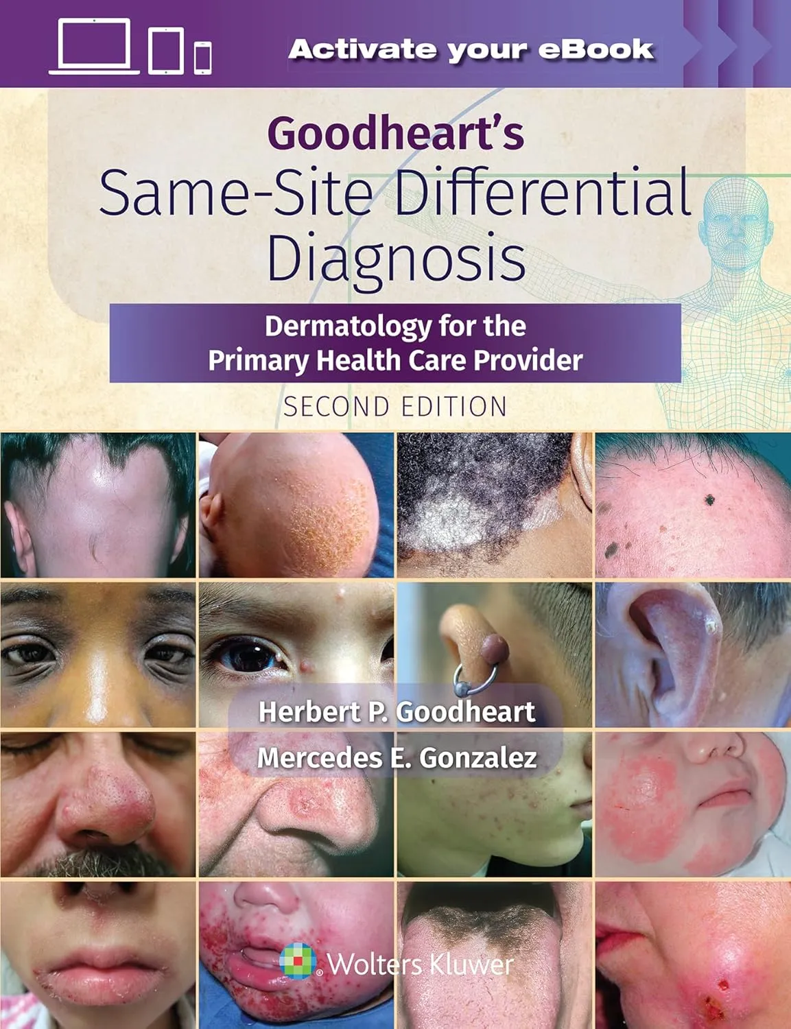 Goodhearts Same Site Differential Diagnosis Dermatology For The Primary Health Care Provider With Access Code 2nd Edition | Hardcover