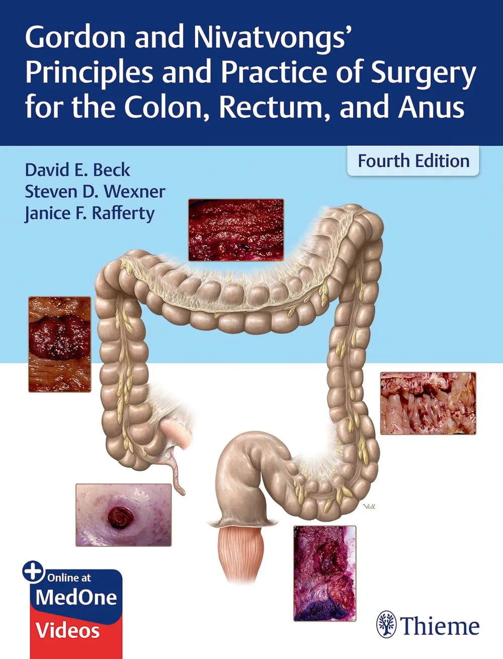 Gordon and Nivatvongs' Principles and Practice of Surgery for the Colon | Rectum | and Anus | 4th Edition | Hardcover