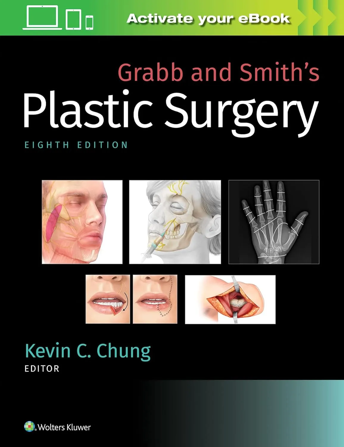 Grabb and Smith's Plastic Surgery | 8th Edition | Hardcover