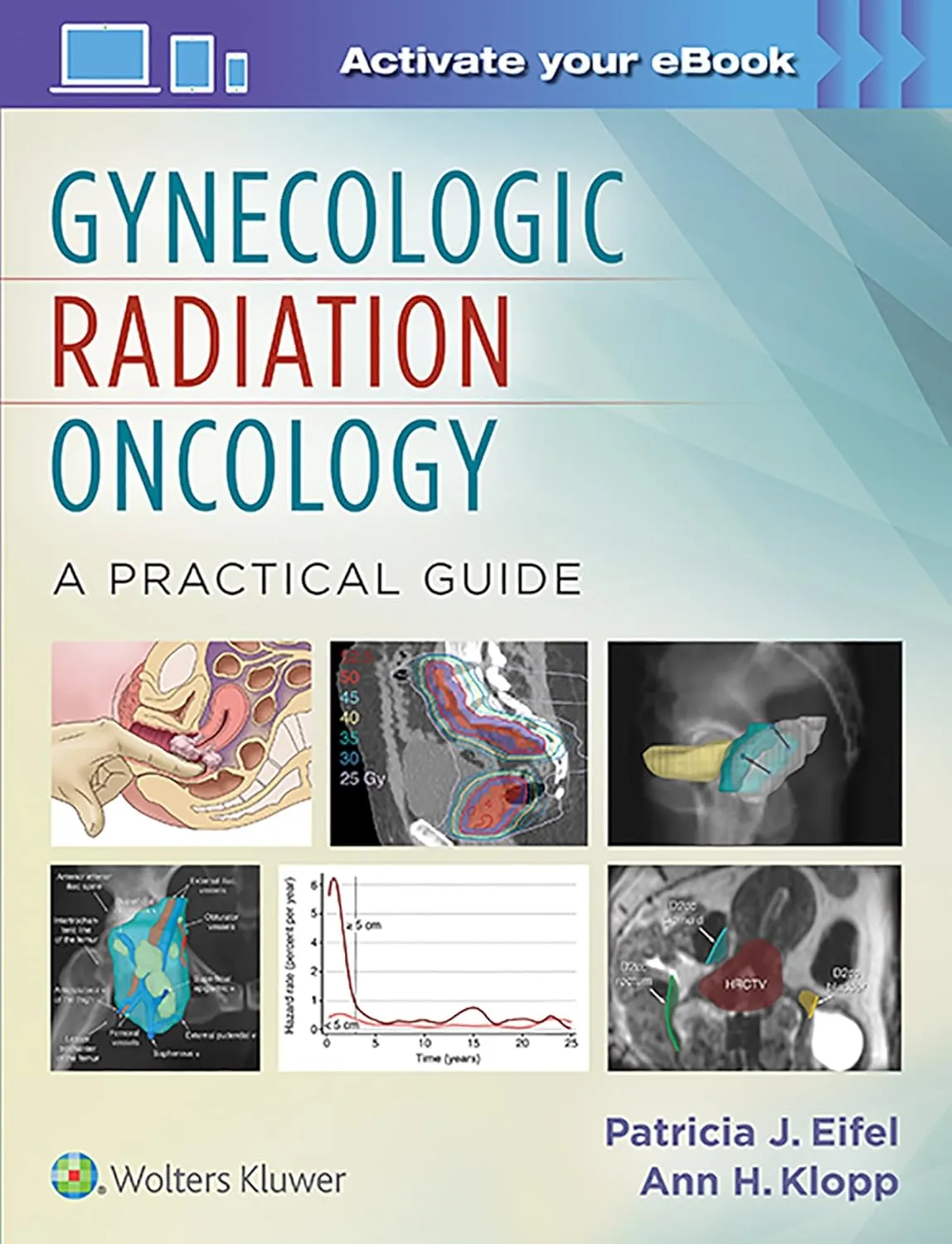 Gynecologic Radiation Oncology | Hardcover