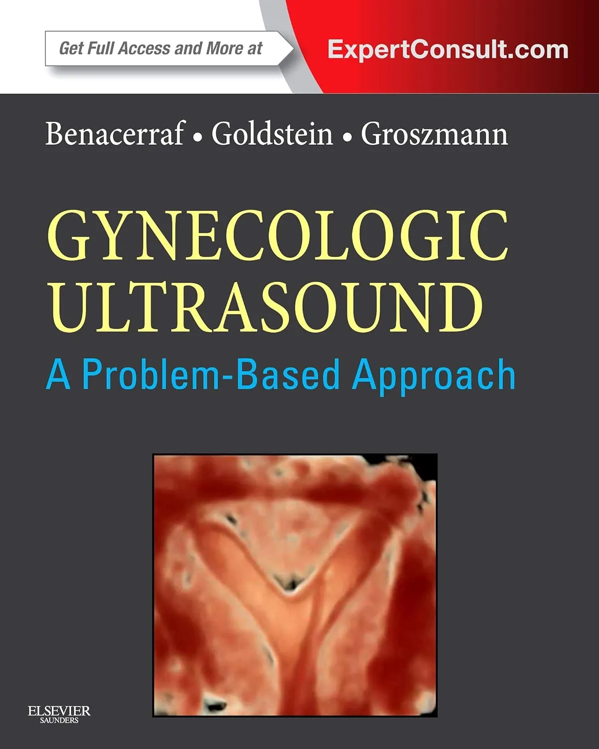 Gynecologic Ultrasound A Problem Based Approach | Hardcover