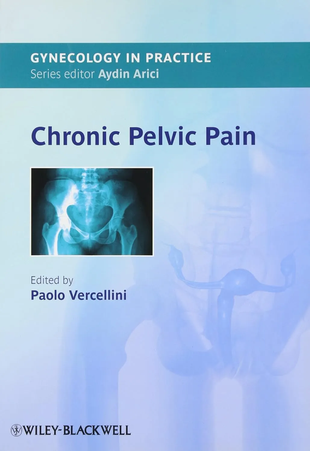 Gynecology in Practice Chronic Pelvic Pain | Paperback