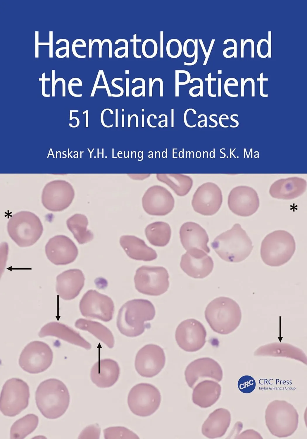 Haematology And The Asian Patient 51 Clinical Cases | Paperback