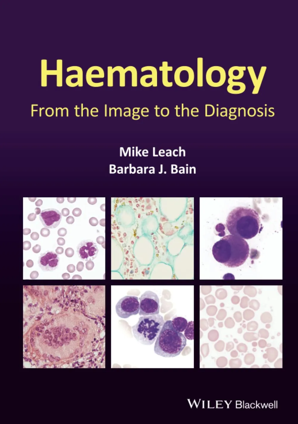 Haematology From The Image To The Diagnosis | Hardcover