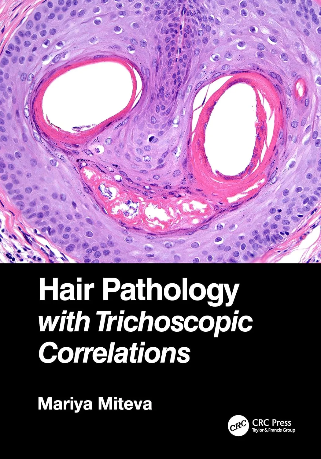 Hair Pathology With Trichoscopic Correlations | Hardcover