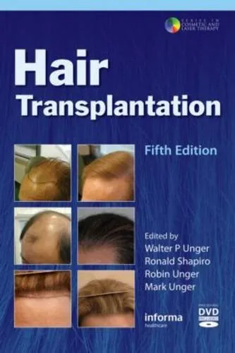 Hair Transplantation | 5th Edition | With CD | Hardcover