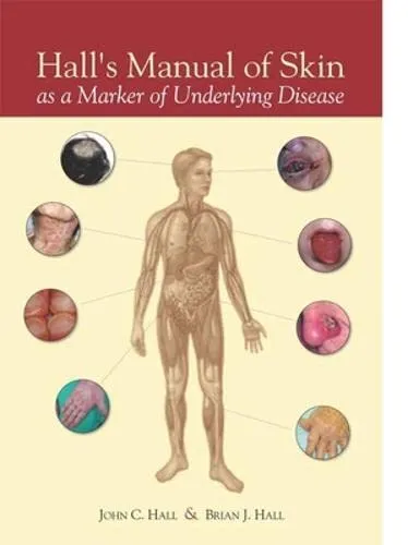 Hall's Manual of Skin as a Marker of Underlying Disease | Hardcover