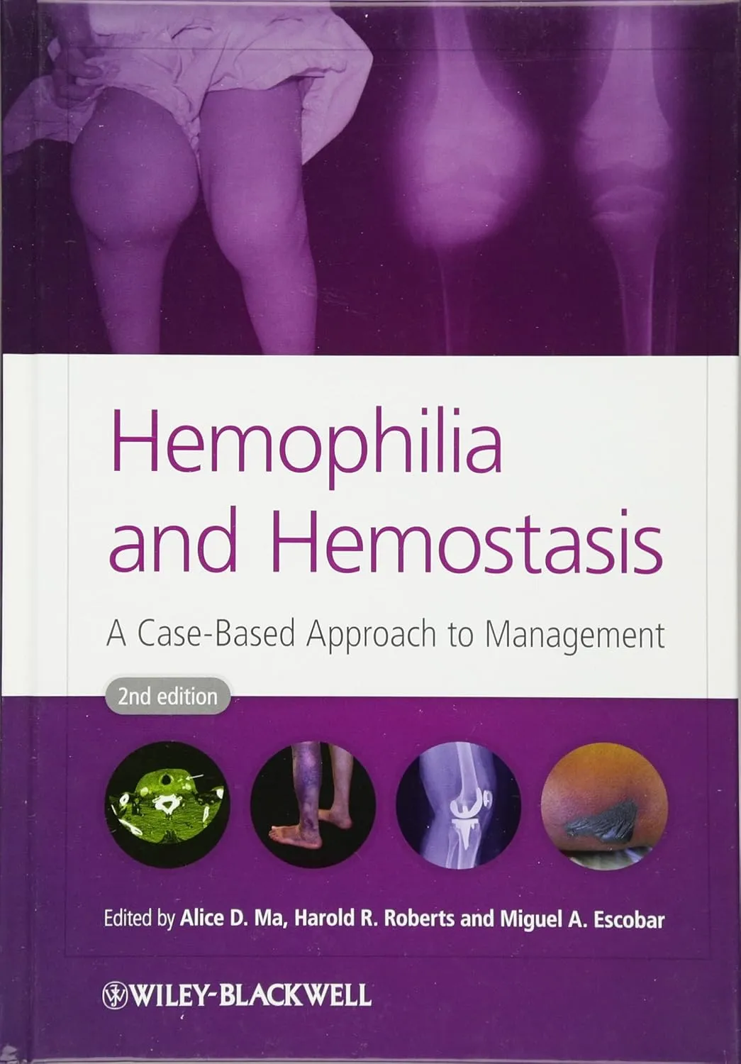 Hamophilia and Hemostasis | 2nd Edition | Hardcover