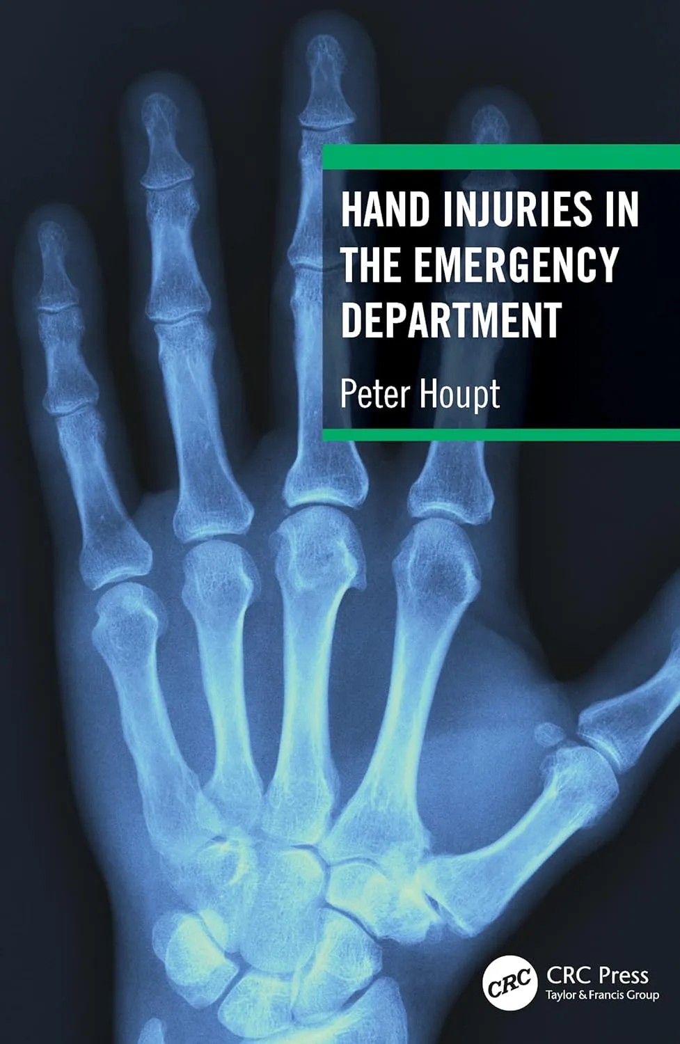 Hand Injuries In The Emergency Department | Paperback
