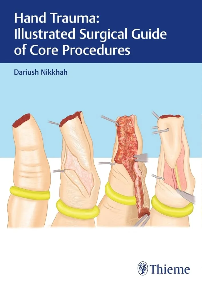 Hand Trauma Illustrated Surgical Guide of Core Procedures | Hardcover