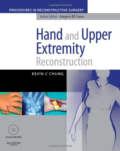 Hand and Upper Extremity Reconstruction | With DVD | Hardcover