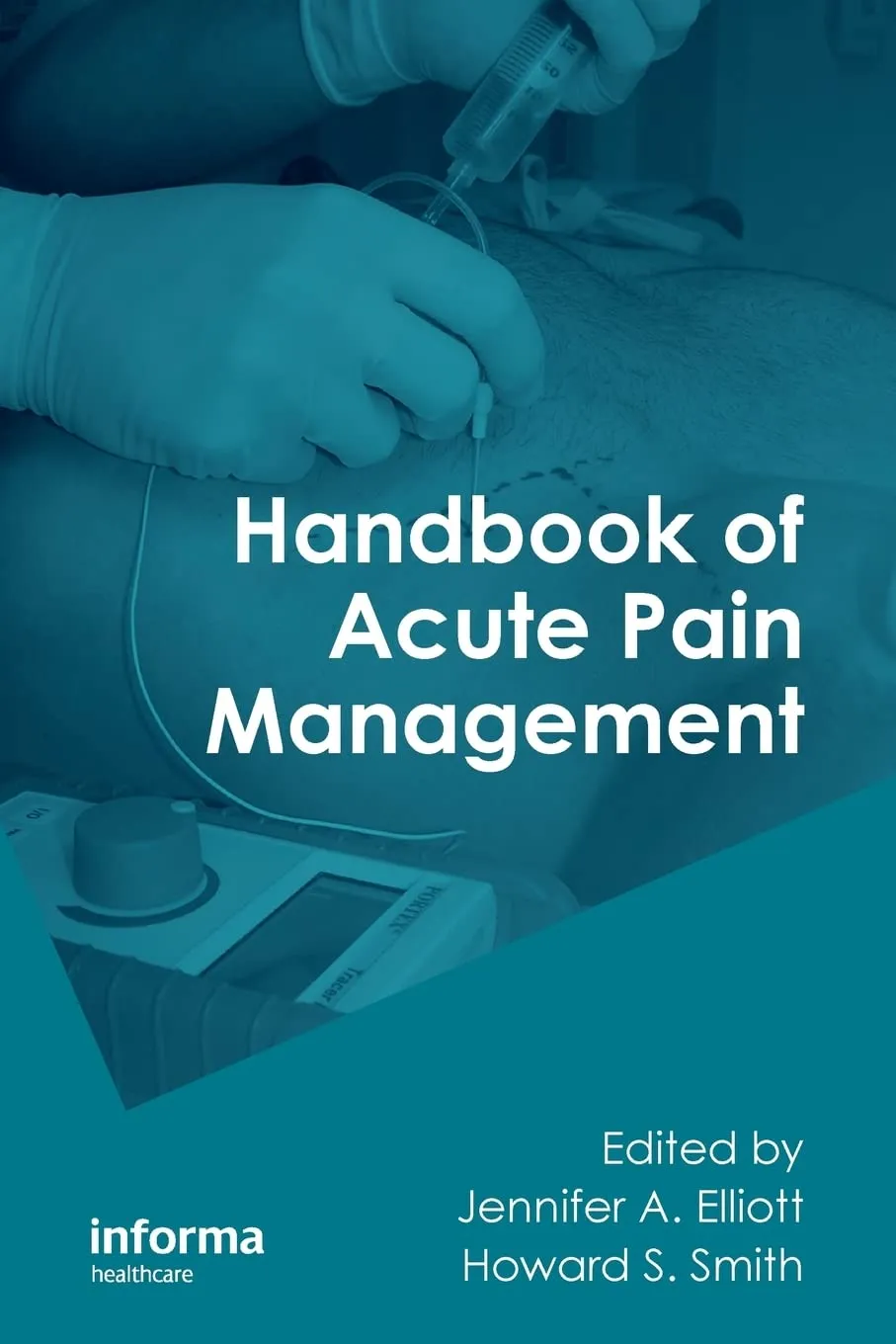 Handbook of Acute Pain Management | Paperback