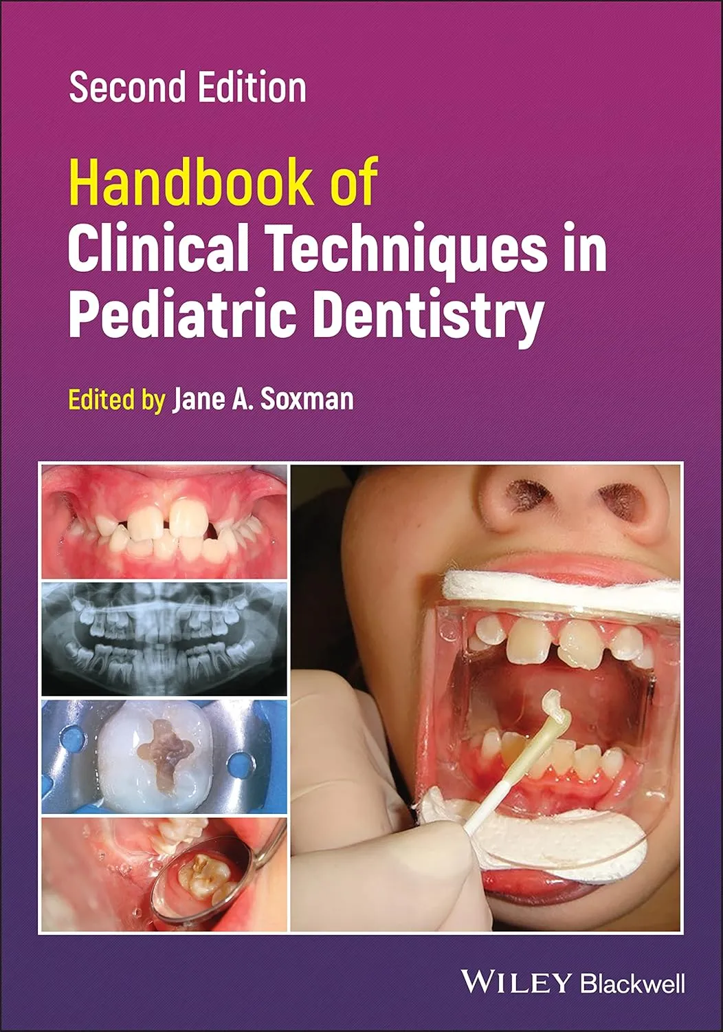 Handbook Of Clinical Techniques In Pediatric Dentistry 2nd Edition | Paperback
