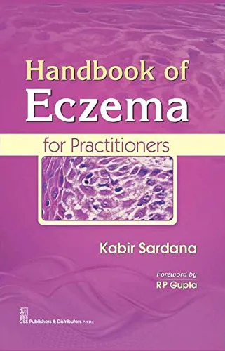 Handbook of Eczema for Practitioners | Hardcover