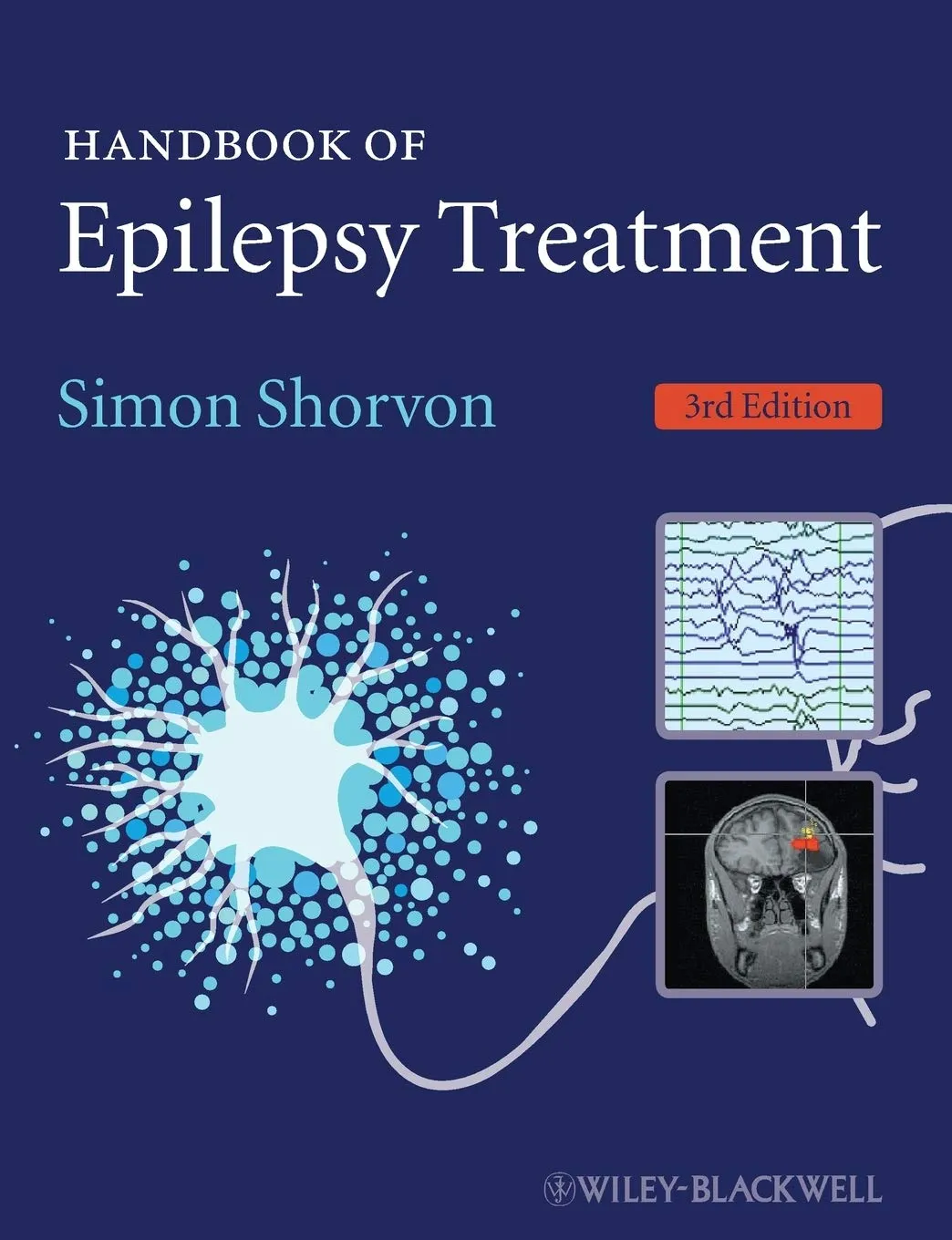Handbook of Epilepsy Treatment | Third Edition | Paperback