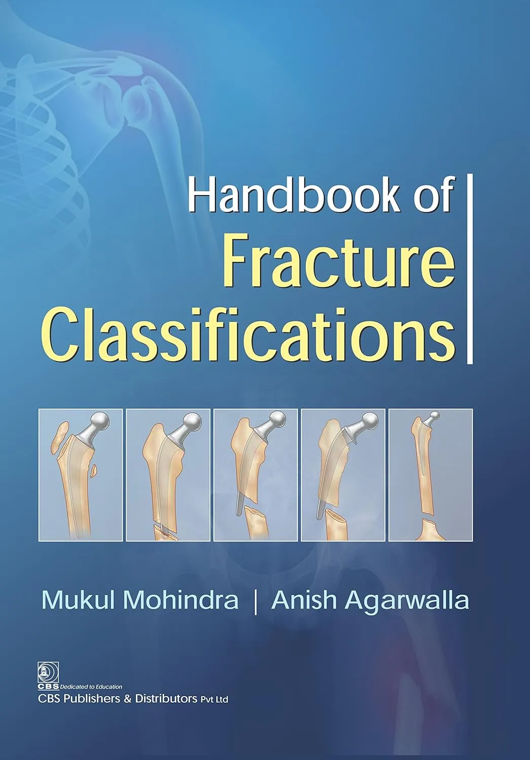 Handbook of Fracture Classifications | Paperback