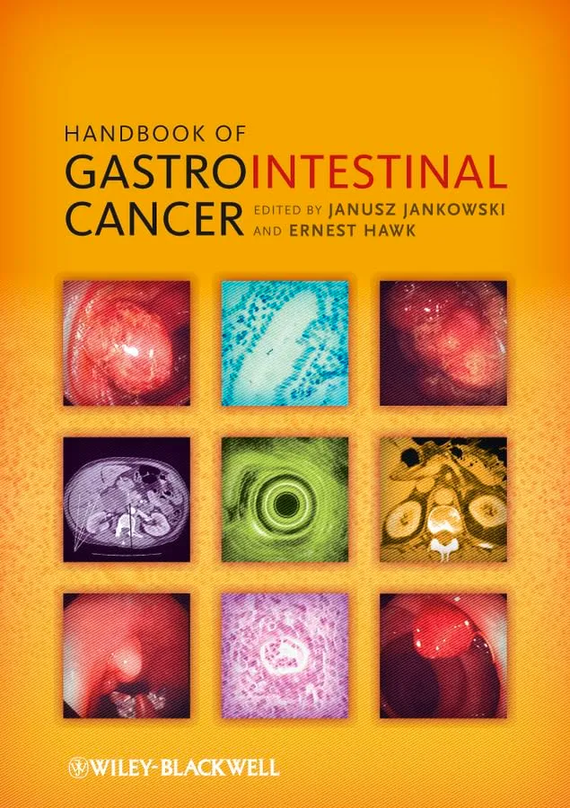 Handbook of Gstrointestinal Cancer | Paperback