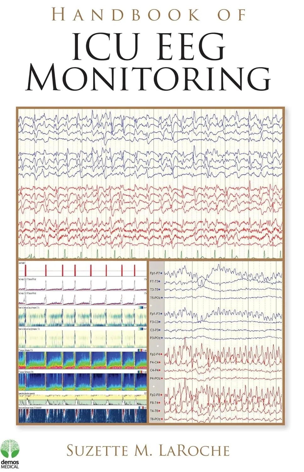 Handbook of ICU EEG Monitoring | Paperback