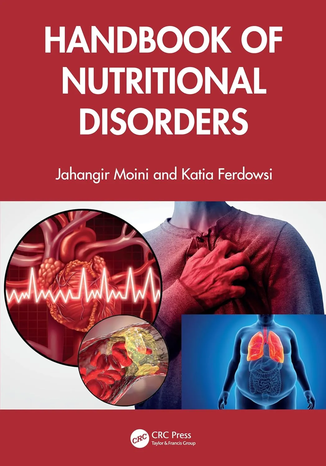 Handbook Of Nutritional Disorders | Paperback