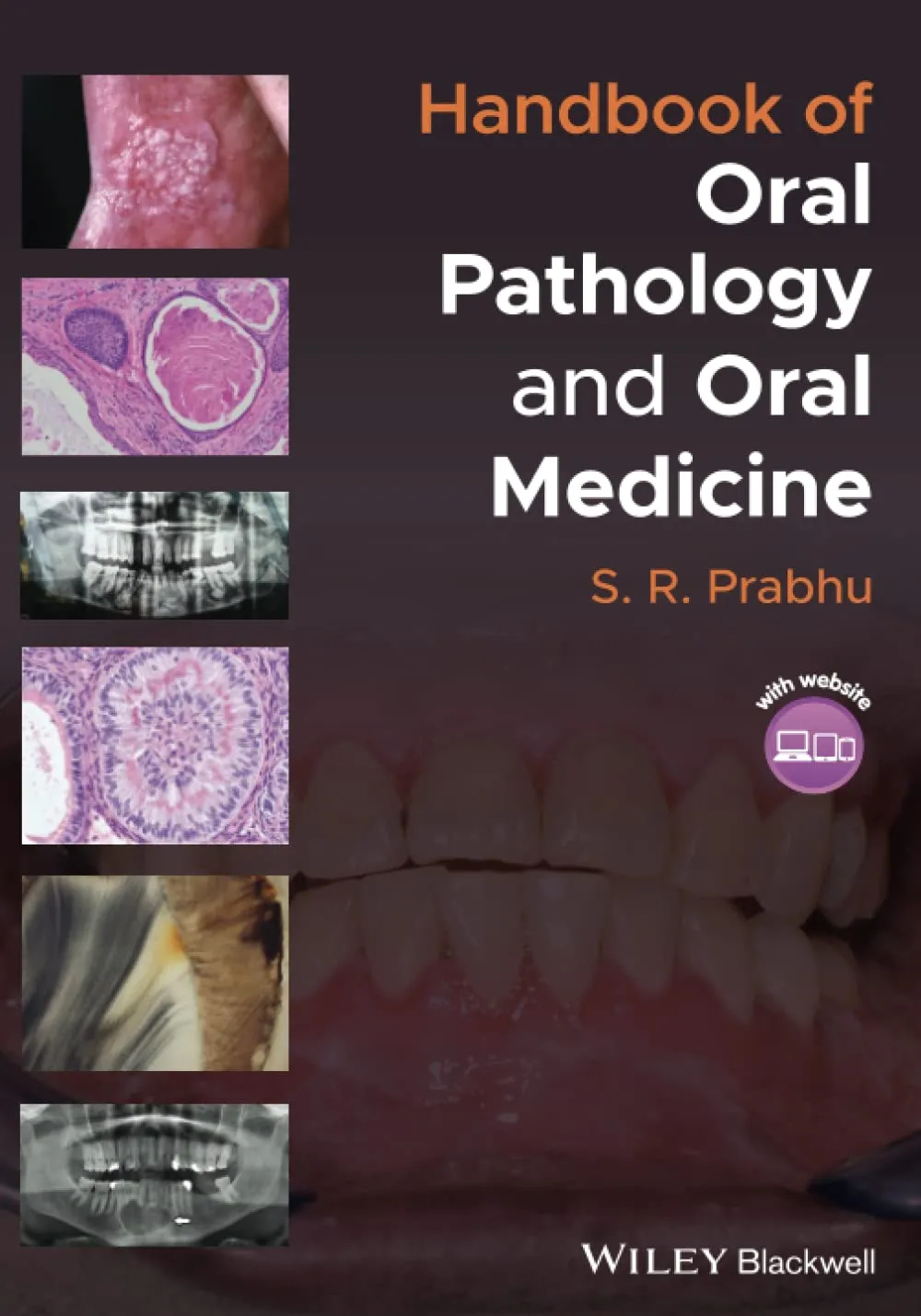 Handbook Of Oral Pathology And Oral Medicine | Paperback