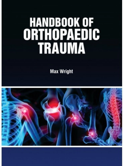 Handbook of Orthopaedic Trauma | Hardcover