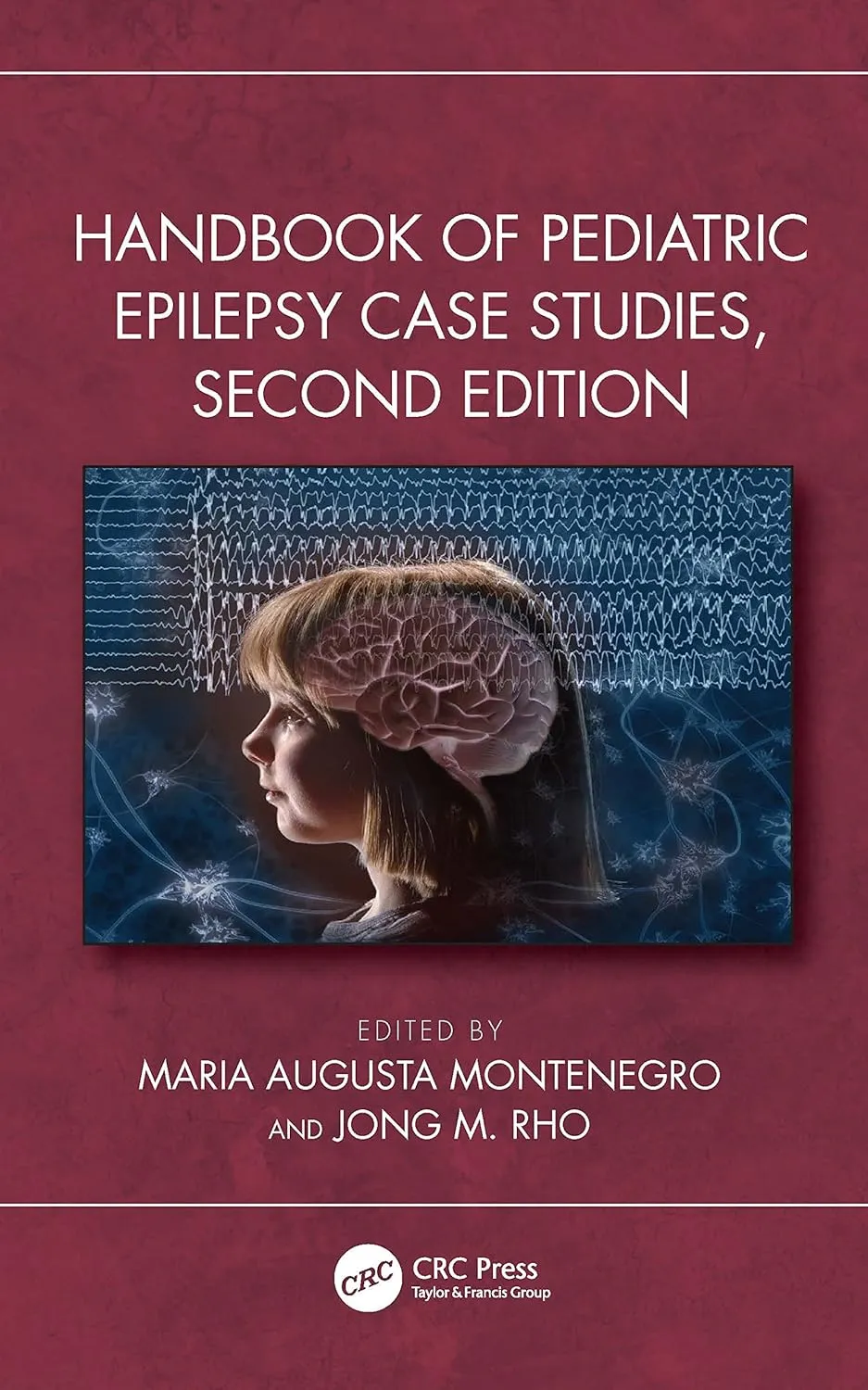 Handbook Of Pediatric Epilepsy Case Studies 2nd Edition | Hardcover