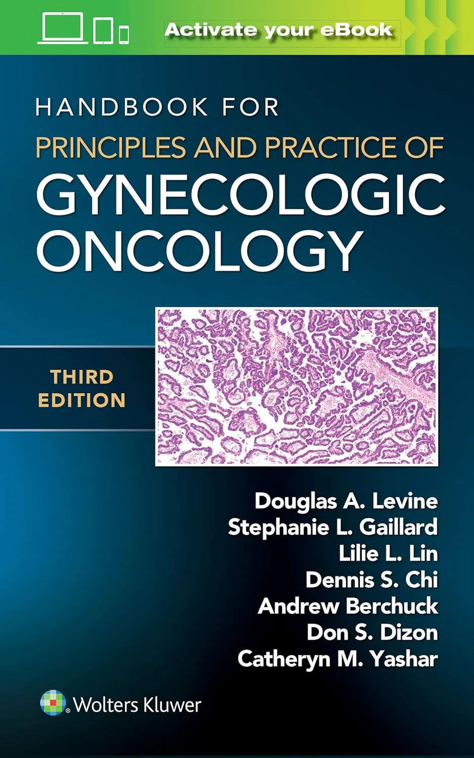 Handbook For Principles And Practice Of Gynecologic Oncology Third Edition | Paperback