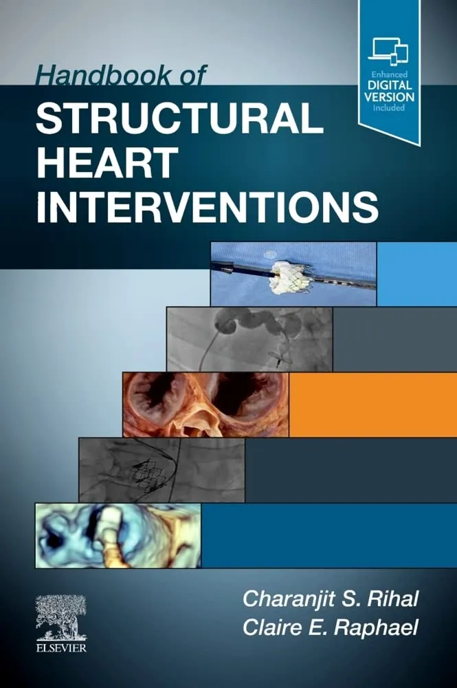 Handbook Of Structural Heart Interventions | Paperback