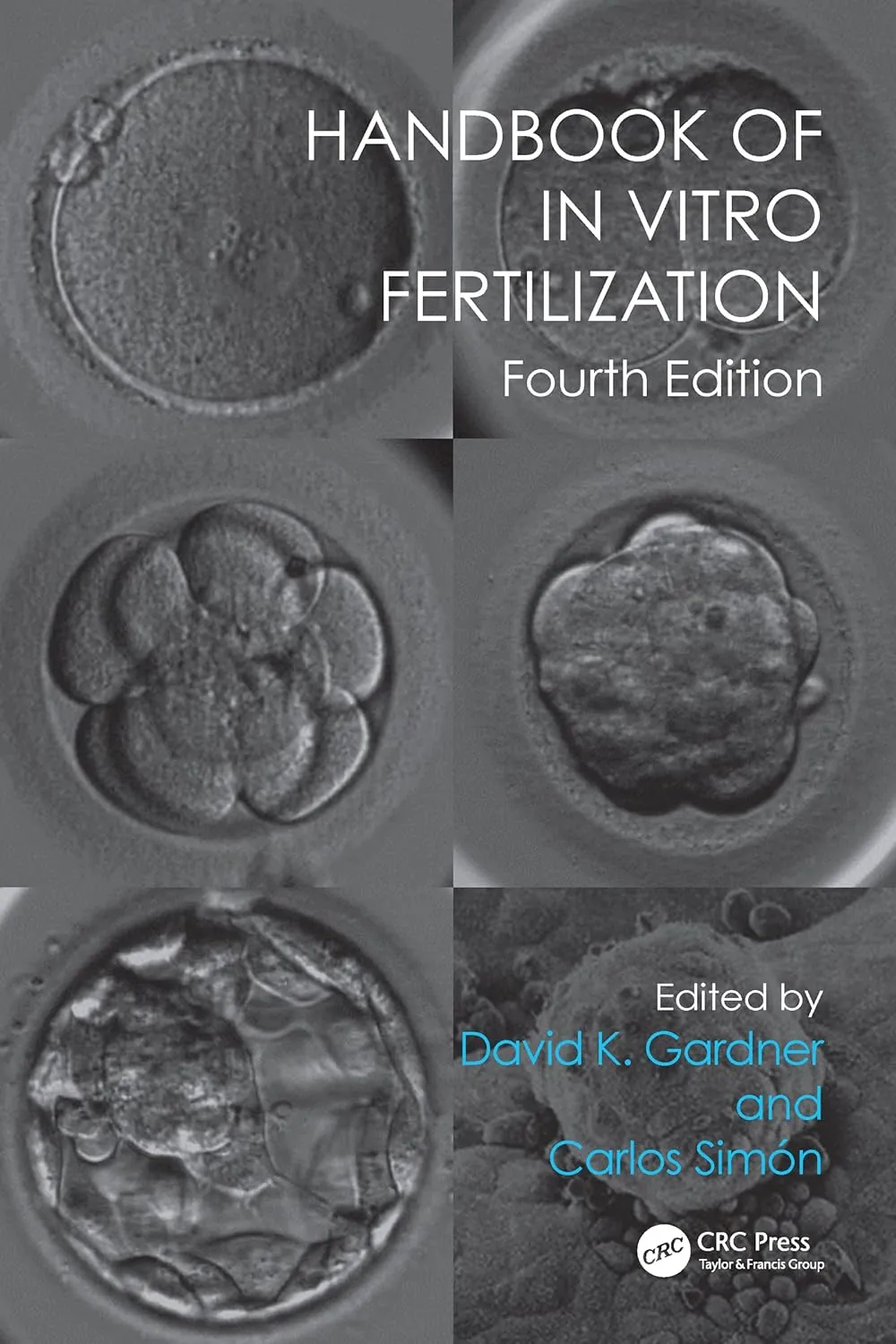 Handbook of in Vitro Fertilization | 4th Edition | Hardcover
