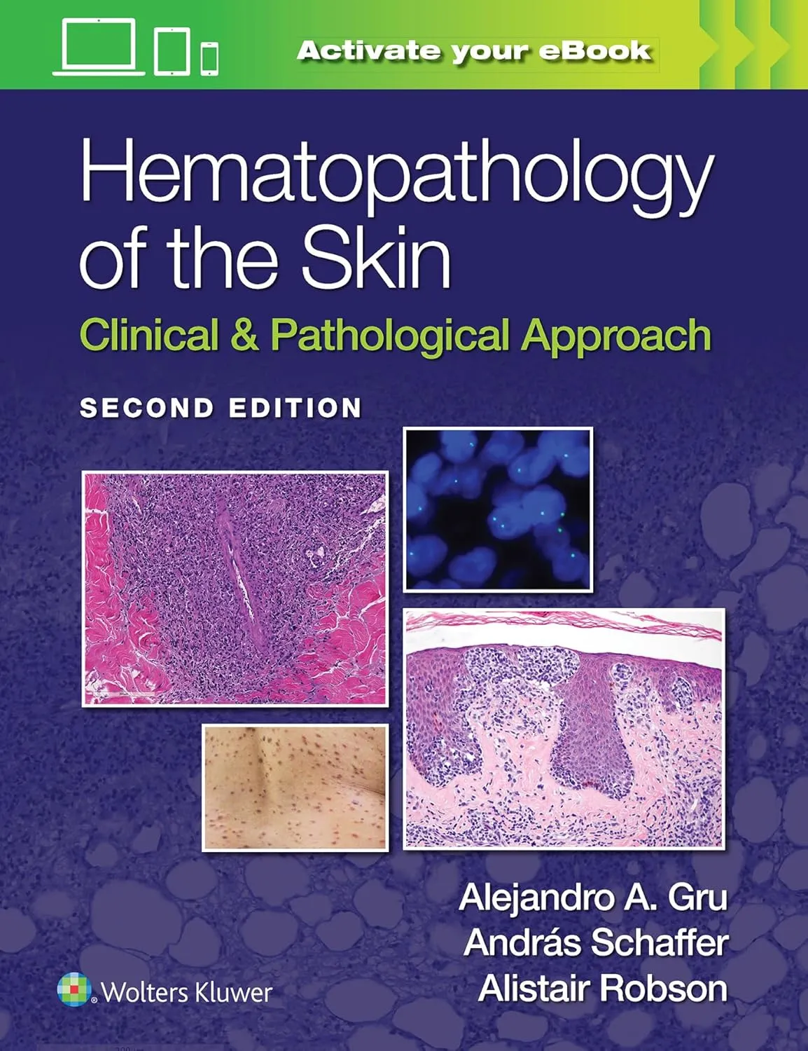 Hematopathology Of The Skin Clinical And Pathological Approach With Access Code 2nd Editiond | Hardcover
