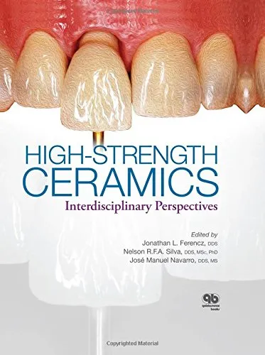 High-Strength Ceramics Interdisciplinary Perspectives | Hardcover
