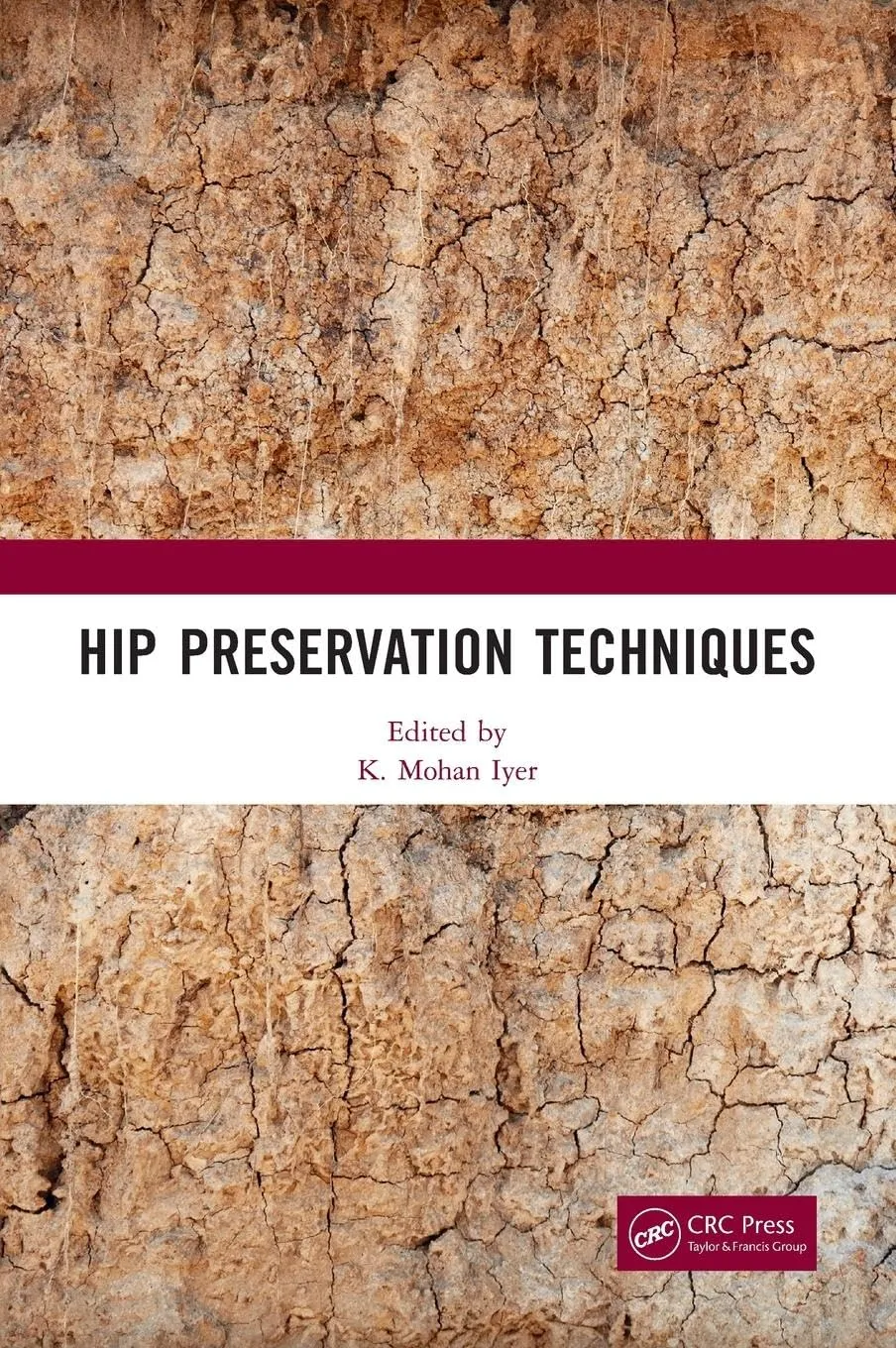Hip Preservation Techniques | Hardcover