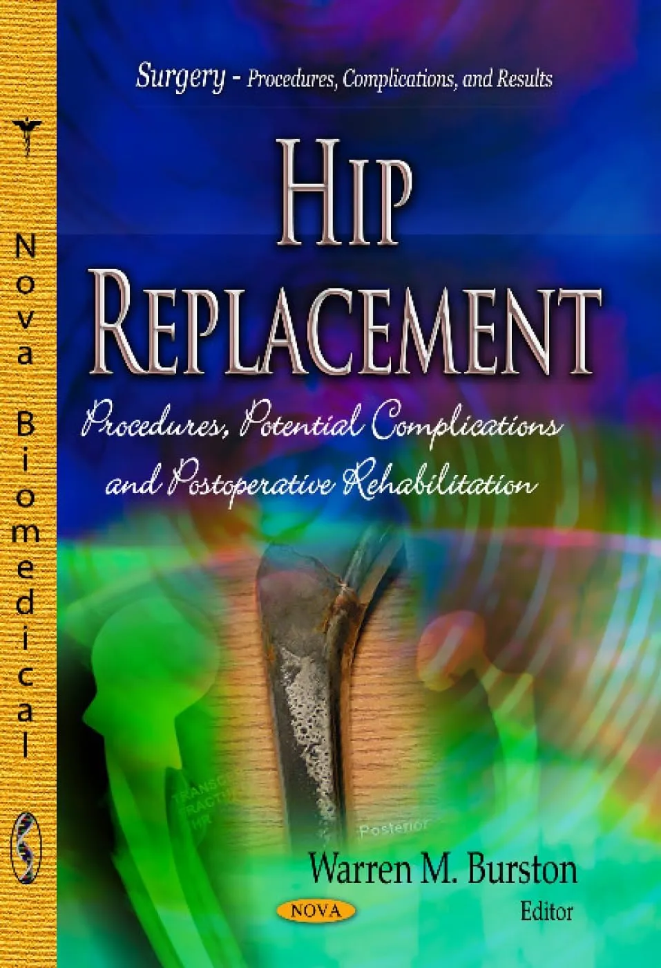 Hip Replacement Procedures | Potential Complications and Postoperative Rehabilitation | Paperback