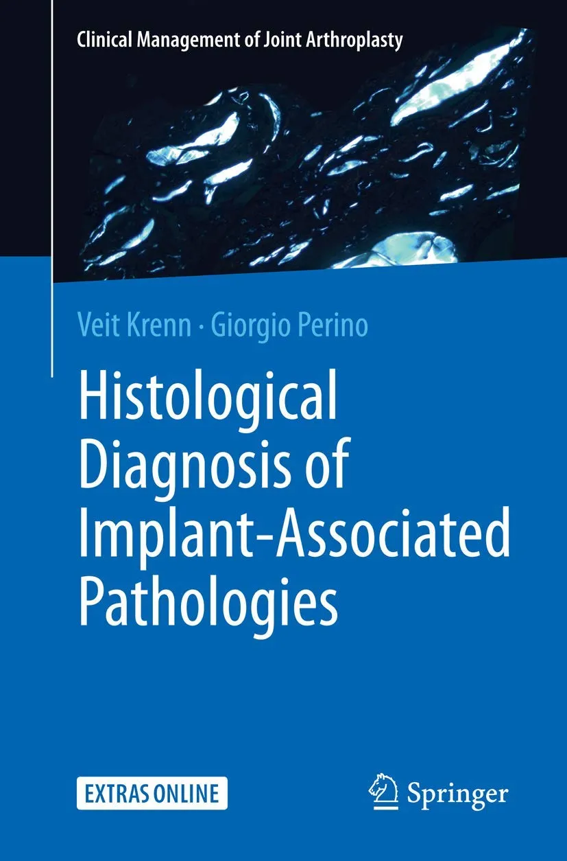 Histological Diagnosis of Implant-Associated Pathologies | Paperback