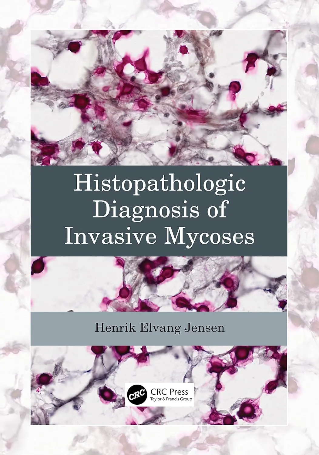 Histopathologic Diagnosis Of Invasive Mycoses | Paperback