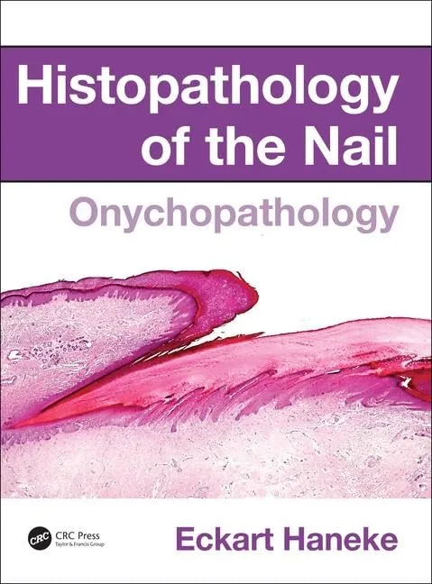 Histopathology of the Nail Onychopathology | Hardcover