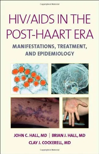 HIV Aids In The Post Haart Era Manifestations Treatment and Epidemiology | Hardcover