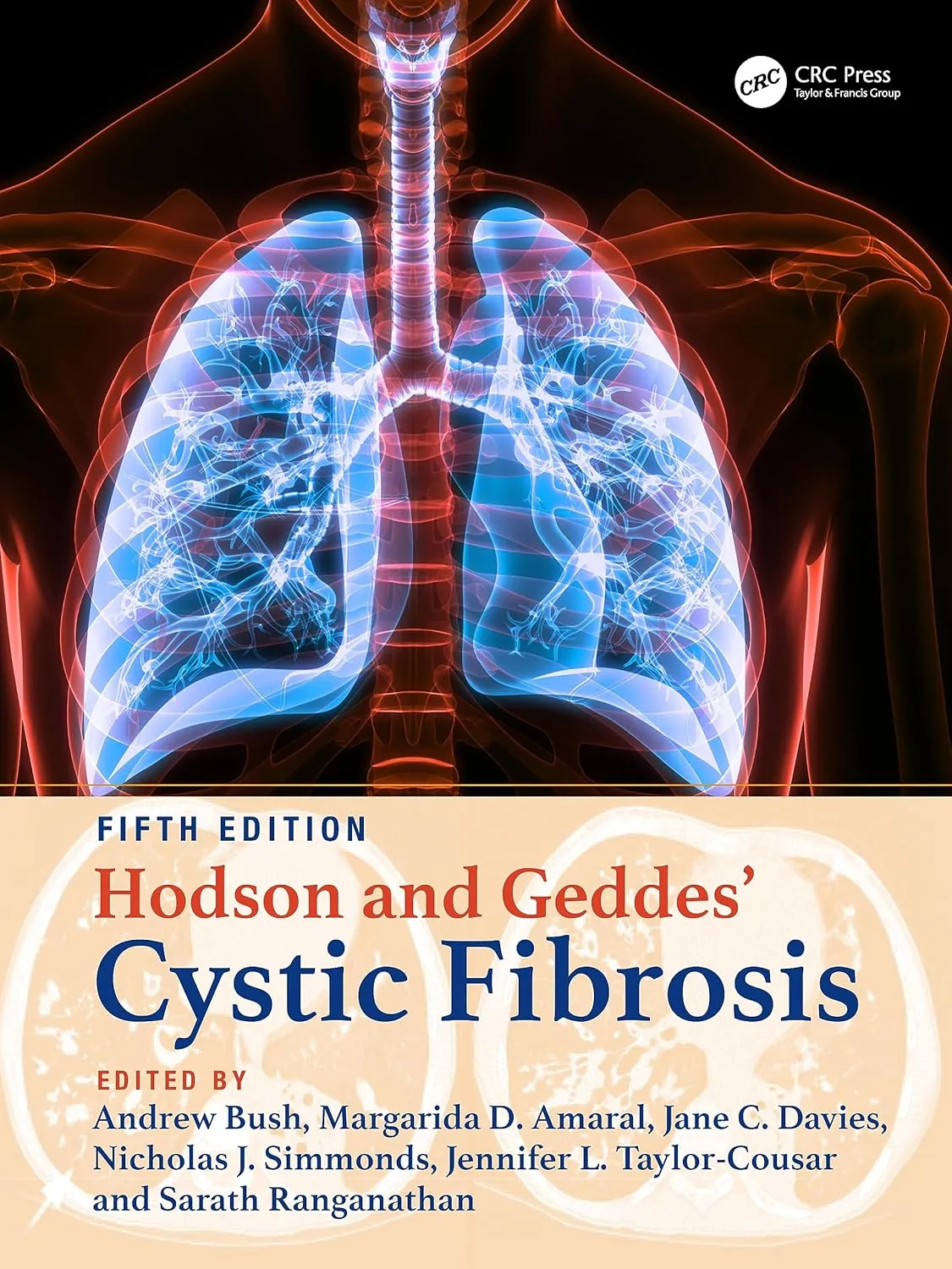 Hodson And Geddes Cystic Fibrosis 5th Edition | Hardcover