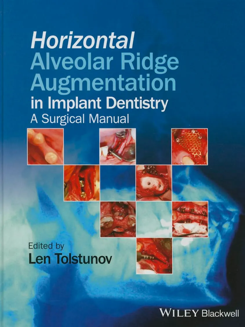 Horizontal Alveolar Ridge Augmentation in Implant Dentistry | Hardcover