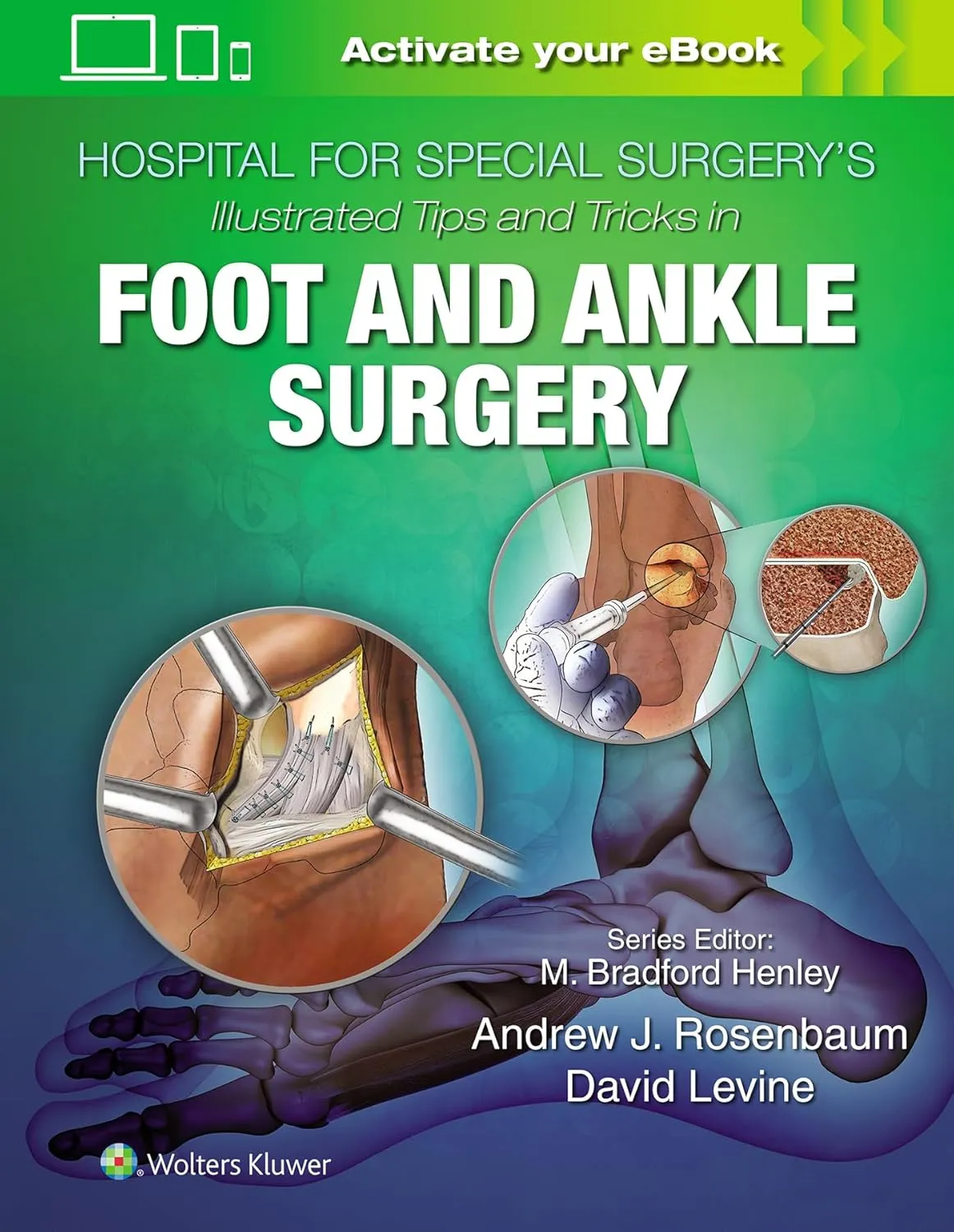 Hospital for Special Surgery's Illustrated Tips and Tricks in Foot and Ankle Surgery | Hardcover