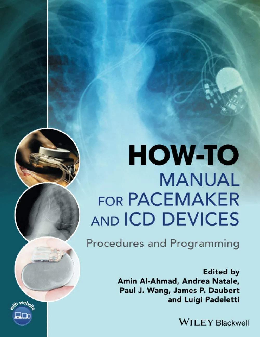 How-To Manual for Pacemaker and ICD Devices | Paperback