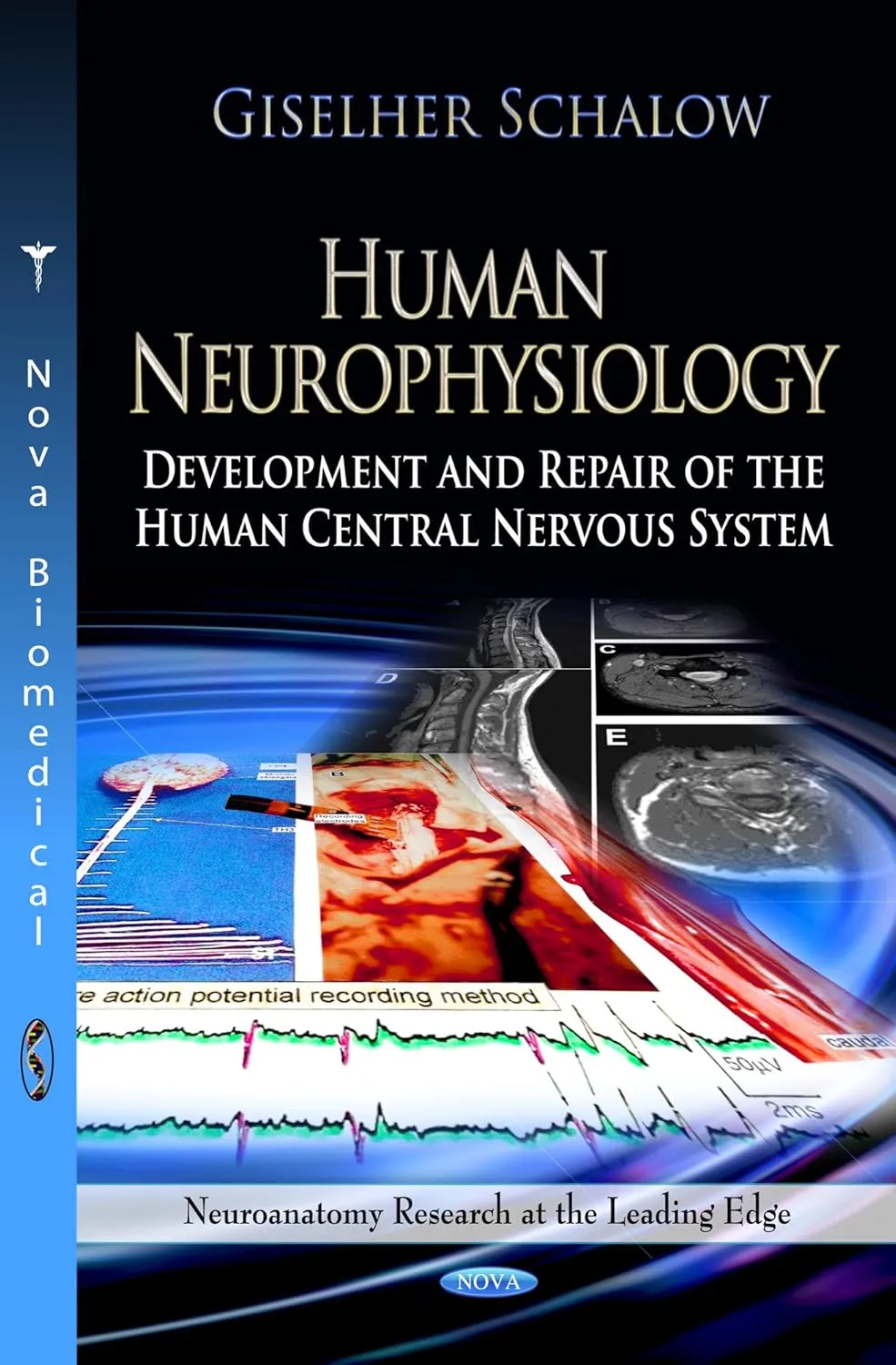 Human Neurophysiology Development and Repair of the Human Central Nervous System | Hardcover
